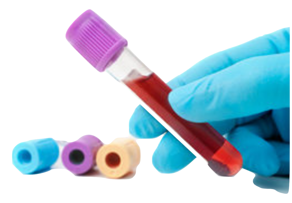 Platelet Rich Plasma - Natural Health Chiropractic